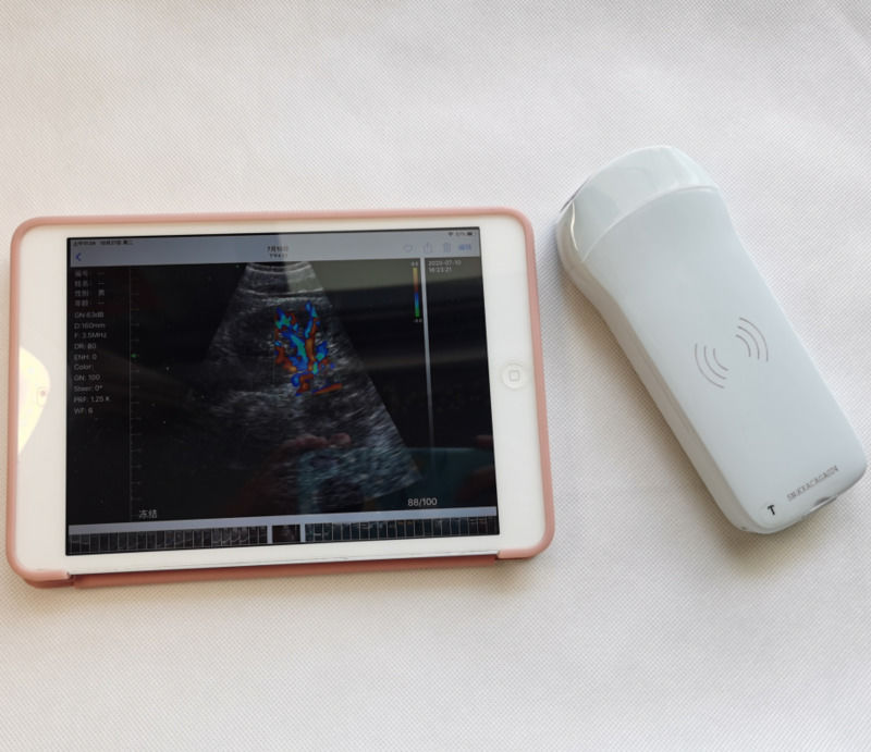 Usg New Look 3d Image GYN Image Laptop Ob Gyn Fetal Υπερήχων Μηχανής Χρώματος Doppler Με Υψηλή Ποιότητα