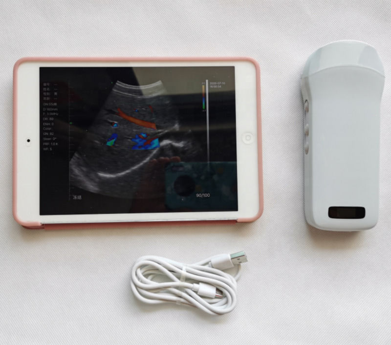 Usg New Look 3d Image GYN Image Laptop Ob Gyn Fetal Υπερήχων Μηχανής Χρώματος Doppler Με Υψηλή Ποιότητα